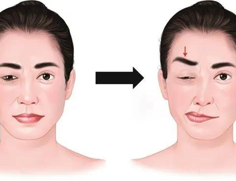 تیک صورت