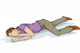 Seizure